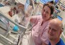 Baby Rory Byers born four months early survives fight for life.