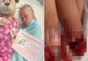 Amelia Smith was taken into surgery for an injured finger, which her mother said staff at Hinchingbrooke Hospital confirmed surgery was not required.