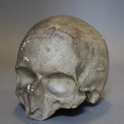 Cast of the skull of the murderer Thomas Luscomb will be on display